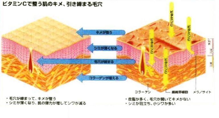 VC-PMGローション